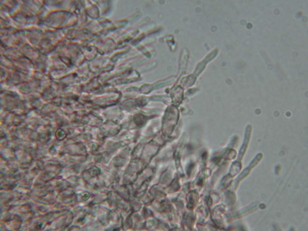 Sconosciuto (cfr. Ascocoryne sp.)